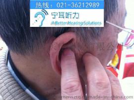 上海瑞声达助听器折扣店特惠售后无忧. 30天之内可免费换货